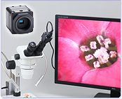 STC HDMI microscope camera adapter set